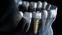dental supply company - 2